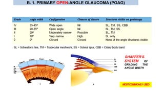 SHAFFER’S
SYSTEM OF
GRADING THE
ANGLE WIDTH
MOSTCOMMONLY USED
B. 1. PRIMARY OPEN-ANGLE GLAUCOMA (POAG)
 