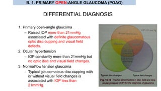 DIFFERENTIAL DIAGNOSIS
1. Primary open-angle glaucoma
– Raised IOP more than 21mmHg
associated with definite glaucomatous
optic disc cupping and visual field
defects.
2. Ocular hypertension
– IOP constantly more than 21mmHg but
no optic disc and visual field changes.
3. Normal/low tension glaucoma
– Typical glaucomatous disc cupping with
or without visual field changes is
associated with IOP less than
21mmHg.
B. 1. PRIMARY OPEN-ANGLE GLAUCOMA (POAG)
 