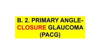 B. 2. PRIMARY ANGLE-
CLOSURE GLAUCOMA
(PACG)
 