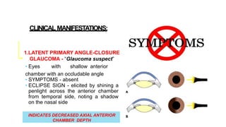 CLINICAL MANIFESTATIONS:
INDICATES DECREASED AXIAL ANTERIOR
CHAMBER DEPTH
1.LATENT PRIMARY ANGLE-CLOSURE
GLAUCOMA - “Glaucoma suspect”
• Eyes with shallow anterior
chamber with an occludable angle
• SYMPTOMS - absent
• ECLIPSE SIGN - elicited by shining a
penlight across the anterior chamber
from temporal side, noting a shadow
on the nasal side
 