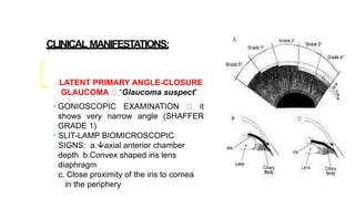 CLINICAL MANIFESTATIONS:
LATENT PRIMARY ANGLE-CLOSURE
GLAUCOMA “Glaucoma suspect”
• GONIOSCOPIC EXAMINATION it
shows very narrow angle (SHAFFER
GRADE 1)
• SLIT-LAMP BIOMICROSCOPIC
SIGNS: a.axial anterior chamber
depth b.Convex shaped iris lens
diaphragm
c. Close proximity of the iris to cornea
in the periphery
 