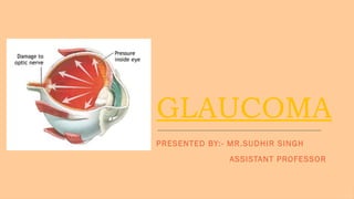 Glaucoma download pptx or ppt helpful for all nursing students | PPTX