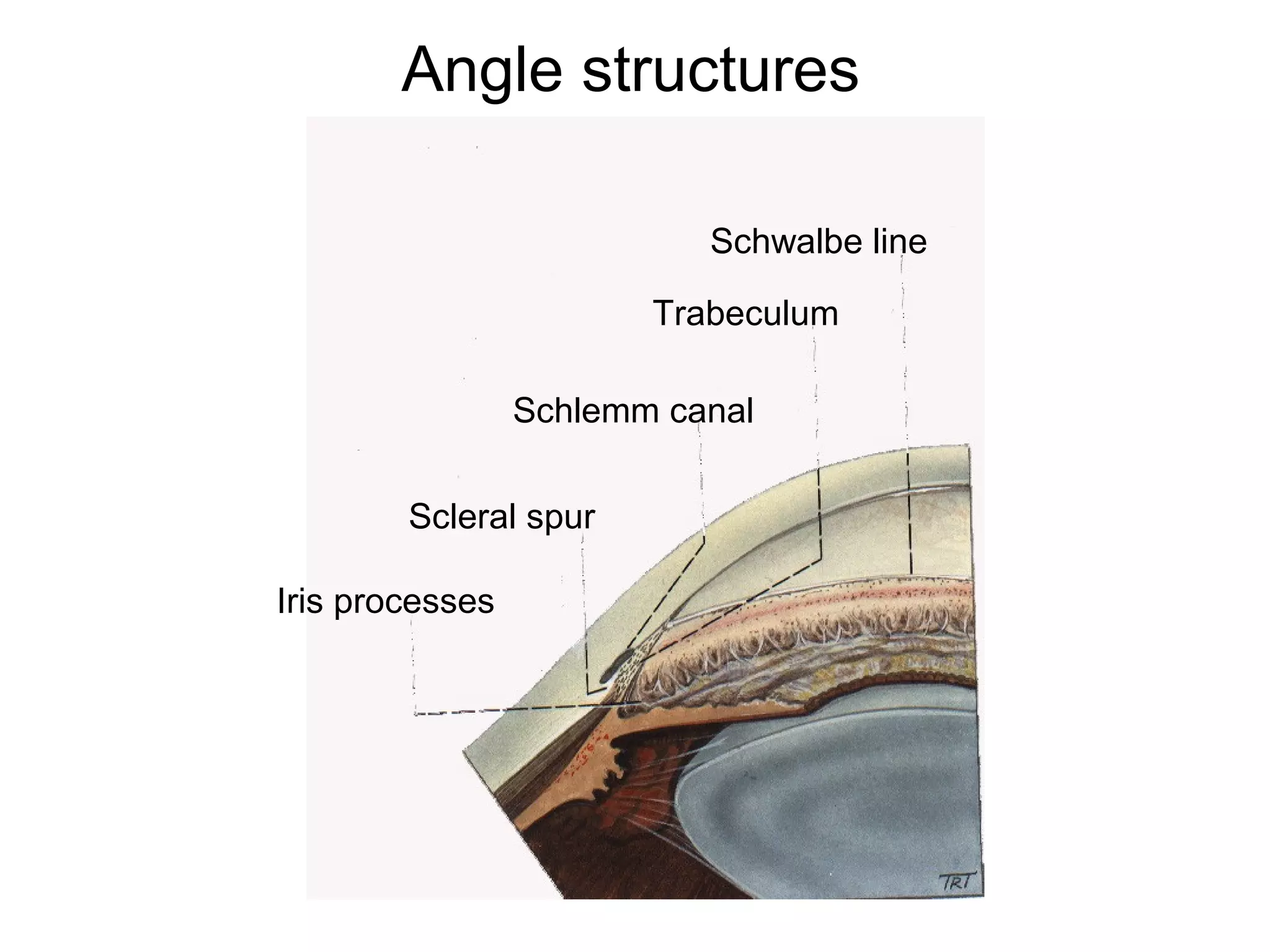 Angle structures
Schwalbe line
Schlemm canal
Trabeculum
Scleral spur
Iris processes
 