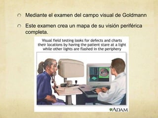 Mediante el examen del campo visual de Goldmann

Este examen crea un mapa de su visión periférica
completa.
 