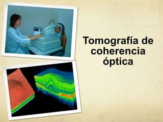 Tomografía de
 coherencia
   óptica
 