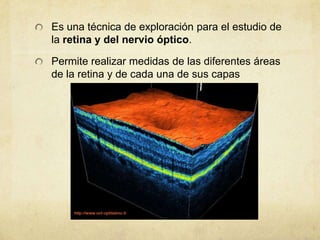 Es una técnica de exploración para el estudio de
la retina y del nervio óptico.

Permite realizar medidas de las diferentes áreas
de la retina y de cada una de sus capas
 