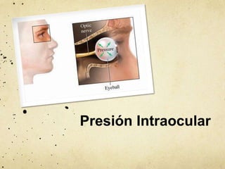 Presión Intraocular
 