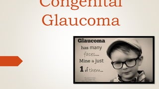 Congenital
Glaucoma
 