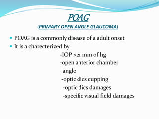 Glaucoma | PPTX