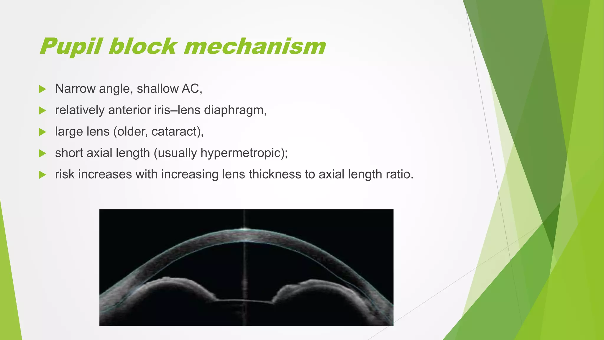 Pupil block mechanism
 Narrow angle, shallow AC,
 relatively anterior iris–lens diaphragm,
 large lens (older, cataract),
 short axial length (usually hypermetropic);
 risk increases with increasing lens thickness to axial length ratio.
 