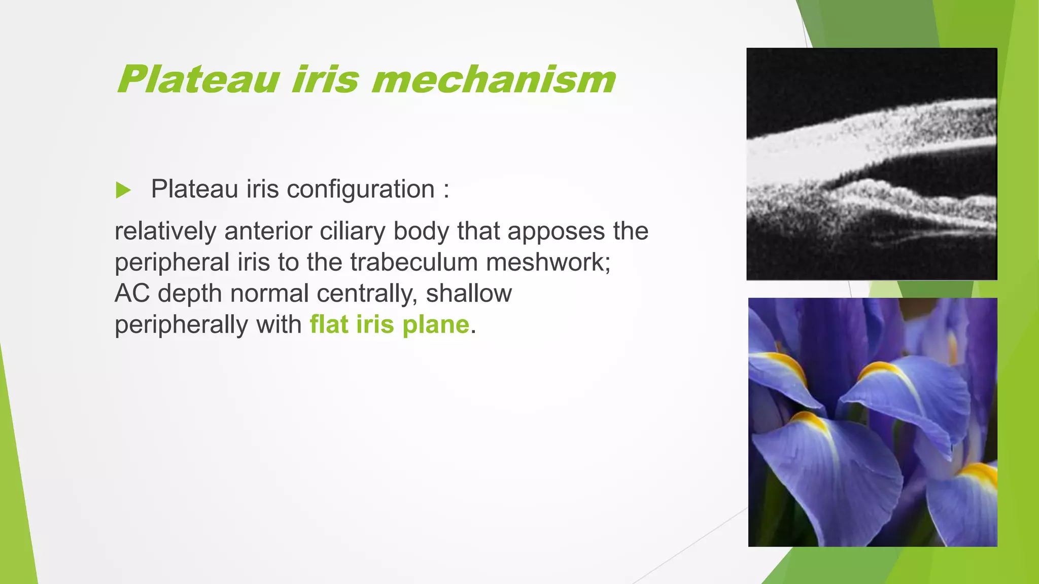 Plateau iris mechanism
 Plateau iris configuration :
relatively anterior ciliary body that apposes the
peripheral iris to the trabeculum meshwork;
AC depth normal centrally, shallow
peripherally with flat iris plane.
 