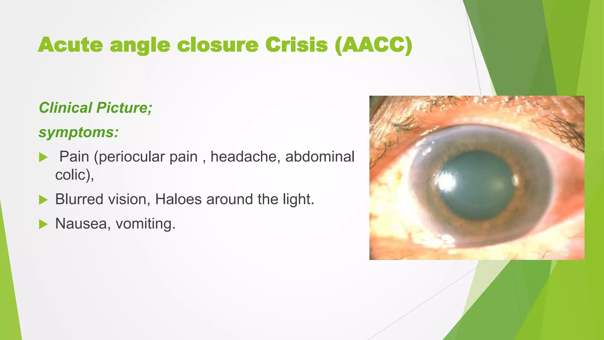 Acute angle closure Crisis (AACC)
Clinical Picture;
symptoms:
 Pain (periocular pain , headache, abdominal
colic),
 Blurred vision, Haloes around the light.
 Nausea, vomiting.
 