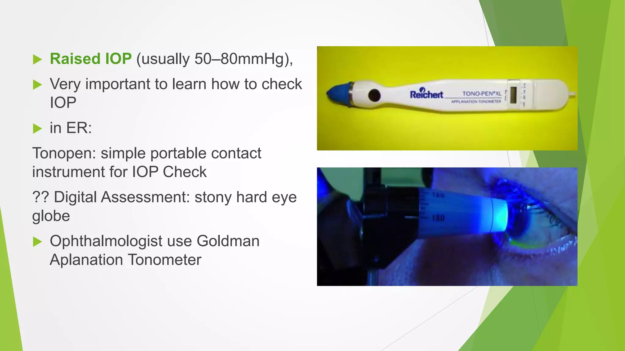  Raised IOP (usually 50–80mmHg),
 Very important to learn how to check
IOP
 in ER:
Tonopen: simple portable contact
instrument for IOP Check
?? Digital Assessment: stony hard eye
globe
 Ophthalmologist use Goldman
Aplanation Tonometer
 