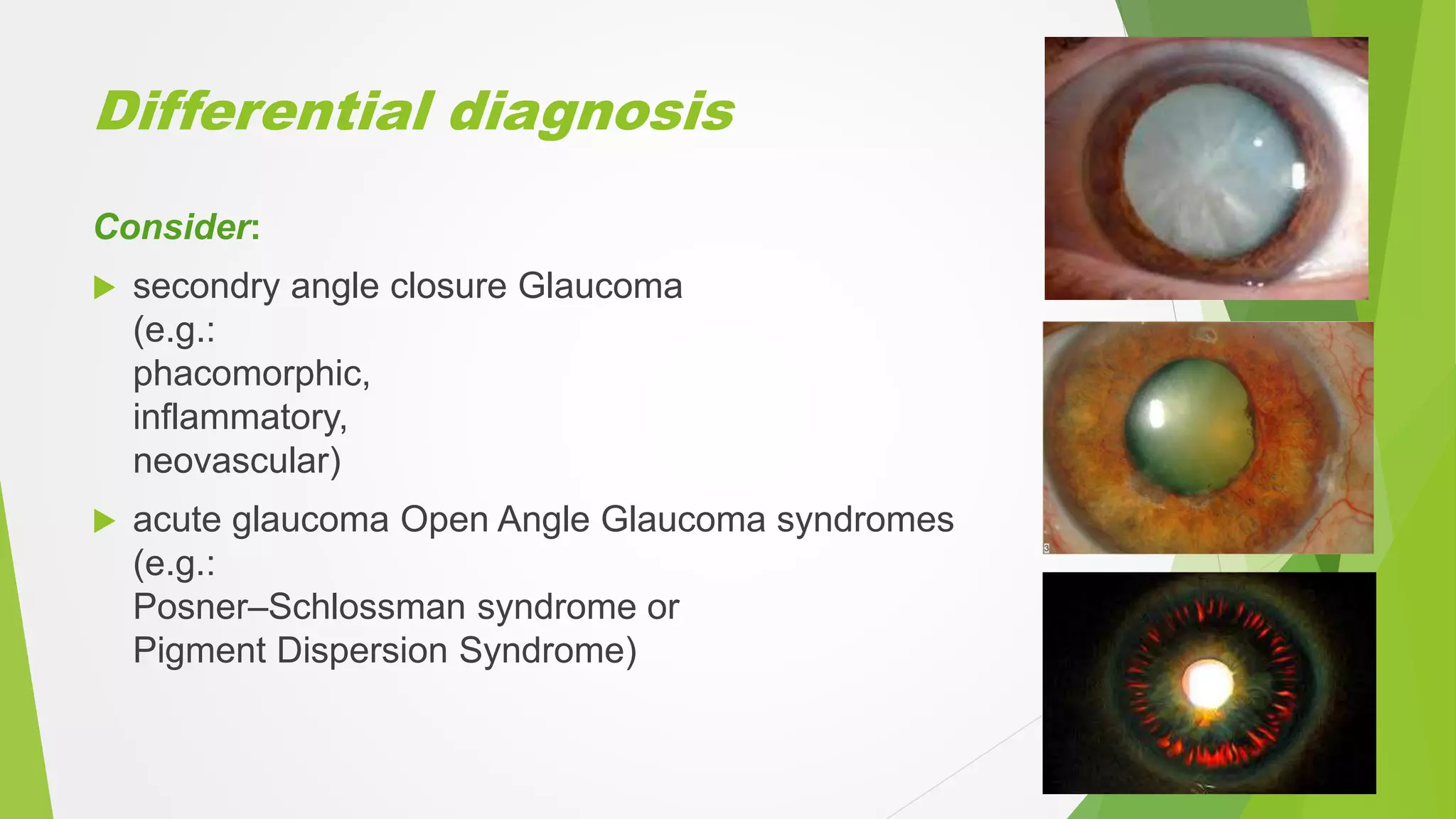 Differential diagnosis
Consider:
 secondry angle closure Glaucoma
(e.g.:
phacomorphic,
inflammatory,
neovascular)
 acute glaucoma Open Angle Glaucoma syndromes
(e.g.:
Posner–Schlossman syndrome or
Pigment Dispersion Syndrome)
 