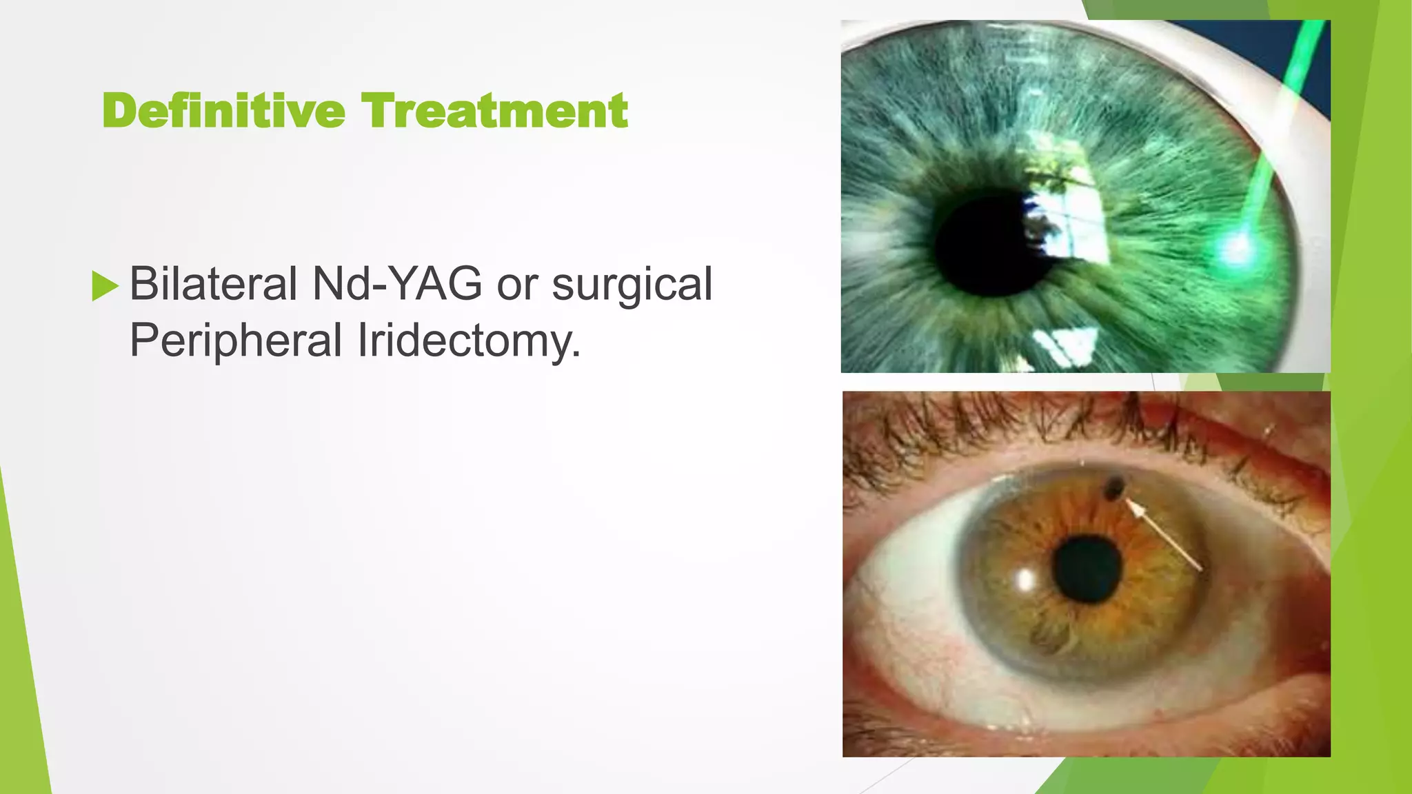 Definitive Treatment
 Bilateral Nd-YAG or surgical
Peripheral Iridectomy.
 