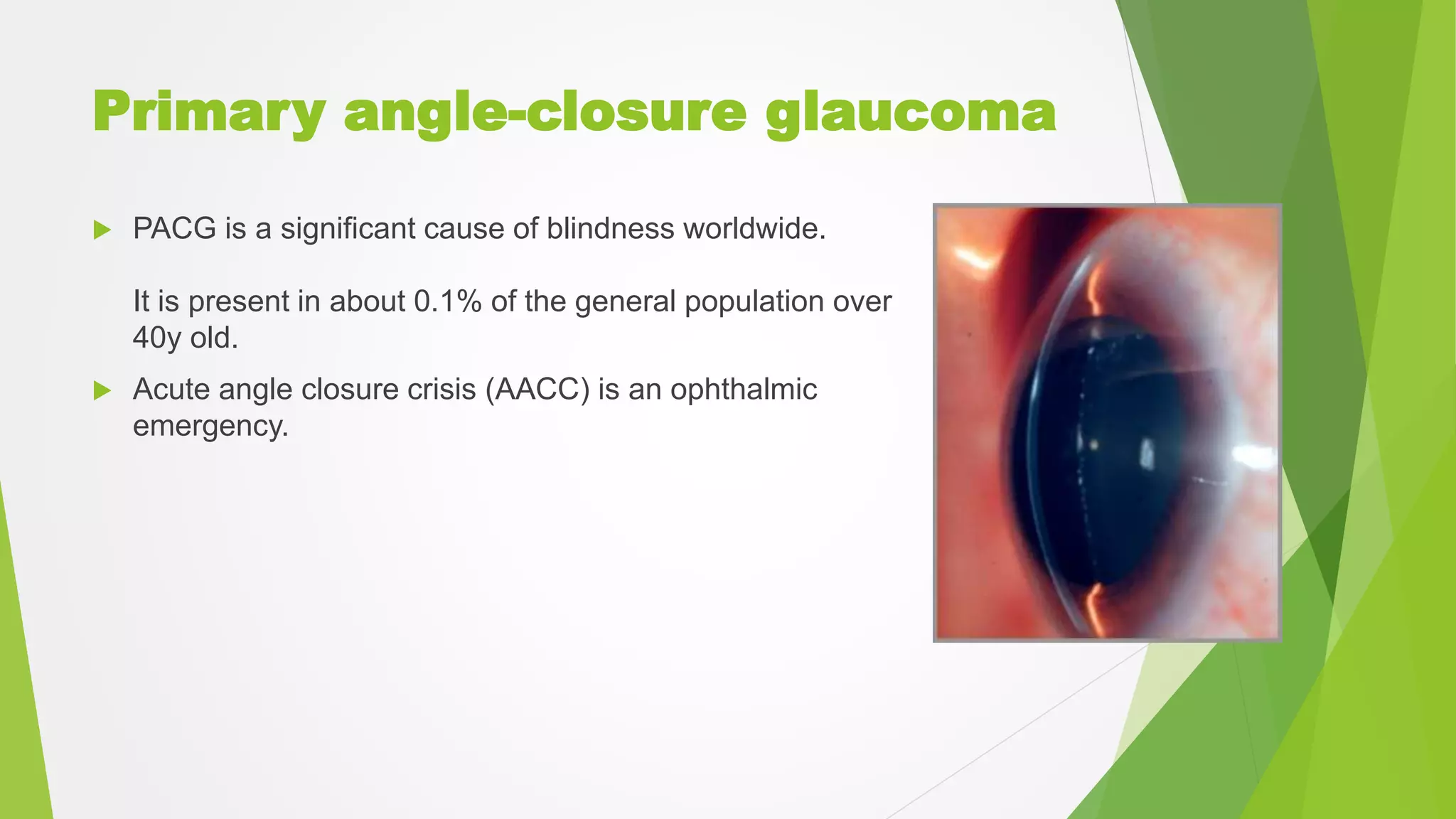 Primary angle-closure glaucoma
 PACG is a significant cause of blindness worldwide.
It is present in about 0.1% of the general population over
40y old.
 Acute angle closure crisis (AACC) is an ophthalmic
emergency.
 