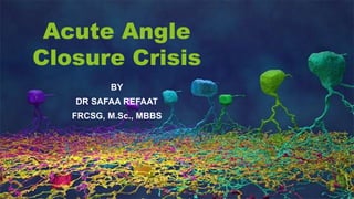 Acute Angle
Closure Crisis
BY
DR SAFAA REFAAT
FRCSG, M.Sc., MBBS
 