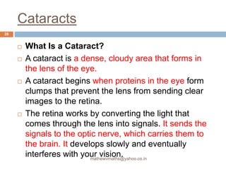 Glaucoma and cataract : | PPTX