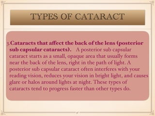 glaucoma and cataract.pdf
