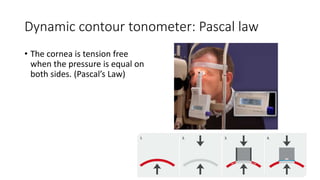 Glaucoma post cataract extraction, vitreoretinal surgery, keratoplasty ...