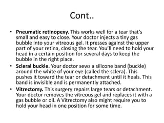Cont..
• Pneumatic retinopexy. This works well for a tear that’s
small and easy to close. Your doctor injects a tiny gas
bubble into your vitreous gel. It presses against the upper
part of your retina, closing the tear. You’ll need to hold your
head in a certain position for several days to keep the
bubble in the right place.
• Scleral buckle. Your doctor sews a silicone band (buckle)
around the white of your eye (called the sclera). This
pushes it toward the tear or detachment until it heals. This
band is invisible and is permanently attached.
• Vitrectomy. This surgery repairs large tears or detachment.
Your doctor removes the vitreous gel and replaces it with a
gas bubble or oil. A Vitrectomy also might require you to
hold your head in one position for some time.
 