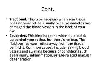 Cont..
• Tractional. This type happens when scar tissue
pulls on your retina, usually because diabetes has
damaged the blood vessels in the back of your
eye.
• Exudative. This kind happens when fluid builds
up behind your retina, but there’s no tear. The
fluid pushes your retina away from the tissue
behind it. Common causes include leaking blood
vessels and swelling because of conditions such
as an injury, inflammation, or age-related macular
degeneration.
 