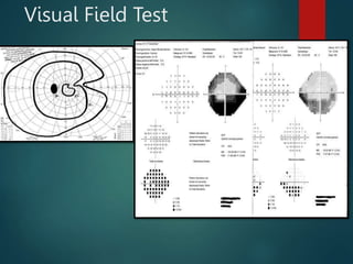 Visual Field Test
 