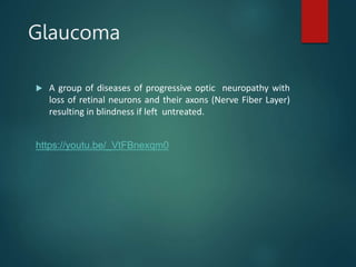 Glaucoma
 A group of diseases of progressive optic neuropathy with
loss of retinal neurons and their axons (Nerve Fiber Layer)
resulting in blindness if left untreated.
https://youtu.be/_VtFBnexqm0
 