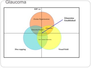 Ocular Hypertention
Glaucoma Suspect
Low Tension Glaucoma
Glaucoma
Established
Glaucoma
IOP >21
Disc cupping Visual Field
Glaucoma
 