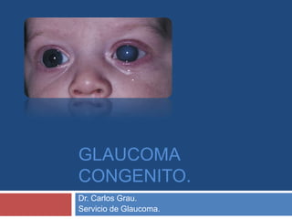 GLAUCOMA CONGENITO. Dr. Carlos Grau. Servicio de Glaucoma. 