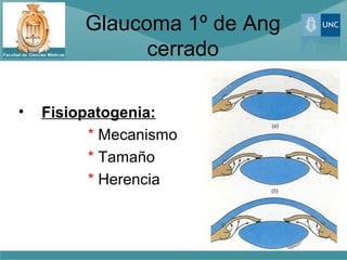 Glaucoma 1º de Ang
               cerrado

•   Fisiopatogenia:
          * Mecanismo
          * Tamaño
          * Herencia
 