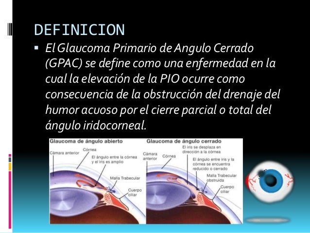 Glaucoma De Ángulo Cerrado. : Glaucoma primario de ángulo cerrado: Lo ...