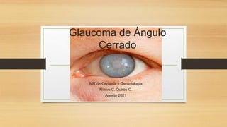 Glaucoma de Ángulo
Cerrado
MR de Geriatría y Gerontología
Nínive C. Quiros C.
Agosto 2021
 