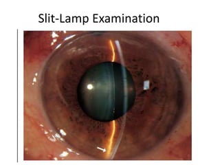 Slit-Lamp Examination
 