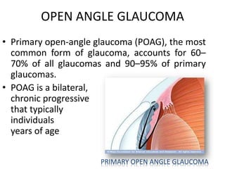 OPEN ANGLE GLAUCOMA
• Primary open-angle glaucoma (POAG), the most
common form of glaucoma, accounts for 60–
70% of all glaucomas and 90–95% of primary
glaucomas.
• POAG is a bilateral,
chronic progressive condition
that typically appears in
individuals over 60
years of age
PRIMARY OPEN ANGLE GLAUCOMA
 