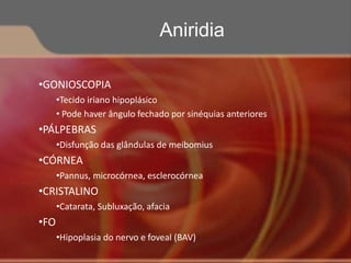 •GONIOSCOPIA
•Tecido iriano hipoplásico
• Pode haver ângulo fechado por sinéquias anteriores
•PÁLPEBRAS
•Disfunção das glândulas de meibomius
•CÓRNEA
•Pannus, microcórnea, esclerocórnea
•CRISTALINO
•Catarata, Subluxação, afacia
•FO
•Hipoplasia do nervo e foveal (BAV)
Aniridia
 