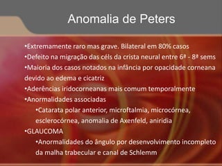•Extremamente raro mas grave. Bilateral em 80% casos
•Defeito na migração das céls da crista neural entre 6ª - 8ª sems
•Maioria dos casos notados na infância por opacidade corneana
devido ao edema e cicatriz
•Aderências iridocorneanas mais comum temporalmente
•Anormalidades associadas
•Catarata polar anterior, microftalmia, microcórnea,
esclerocórnea, anomalia de Axenfeld, aniridia
•GLAUCOMA
•Anormalidades do ângulo por desenvolvimento incompleto
da malha trabecular e canal de Schlemm
Anomalia de Peters
 