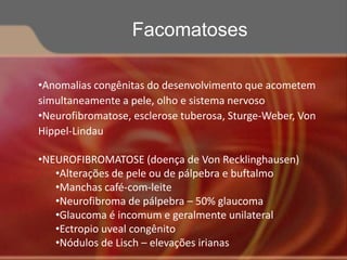 •Anomalias congênitas do desenvolvimento que acometem
simultaneamente a pele, olho e sistema nervoso
•Neurofibromatose, esclerose tuberosa, Sturge-Weber, Von
Hippel-Lindau
•NEUROFIBROMATOSE (doença de Von Recklinghausen)
•Alterações de pele ou de pálpebra e buftalmo
•Manchas café-com-leite
•Neurofibroma de pálpebra – 50% glaucoma
•Glaucoma é incomum e geralmente unilateral
•Ectropio uveal congênito
•Nódulos de Lisch – elevações irianas
Facomatoses
 