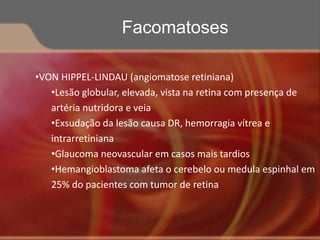 •VON HIPPEL-LINDAU (angiomatose retiniana)
•Lesão globular, elevada, vista na retina com presença de
artéria nutridora e veia
•Exsudação da lesão causa DR, hemorragia vítrea e
intrarretiniana
•Glaucoma neovascular em casos mais tardios
•Hemangioblastoma afeta o cerebelo ou medula espinhal em
25% do pacientes com tumor de retina
Facomatoses
 