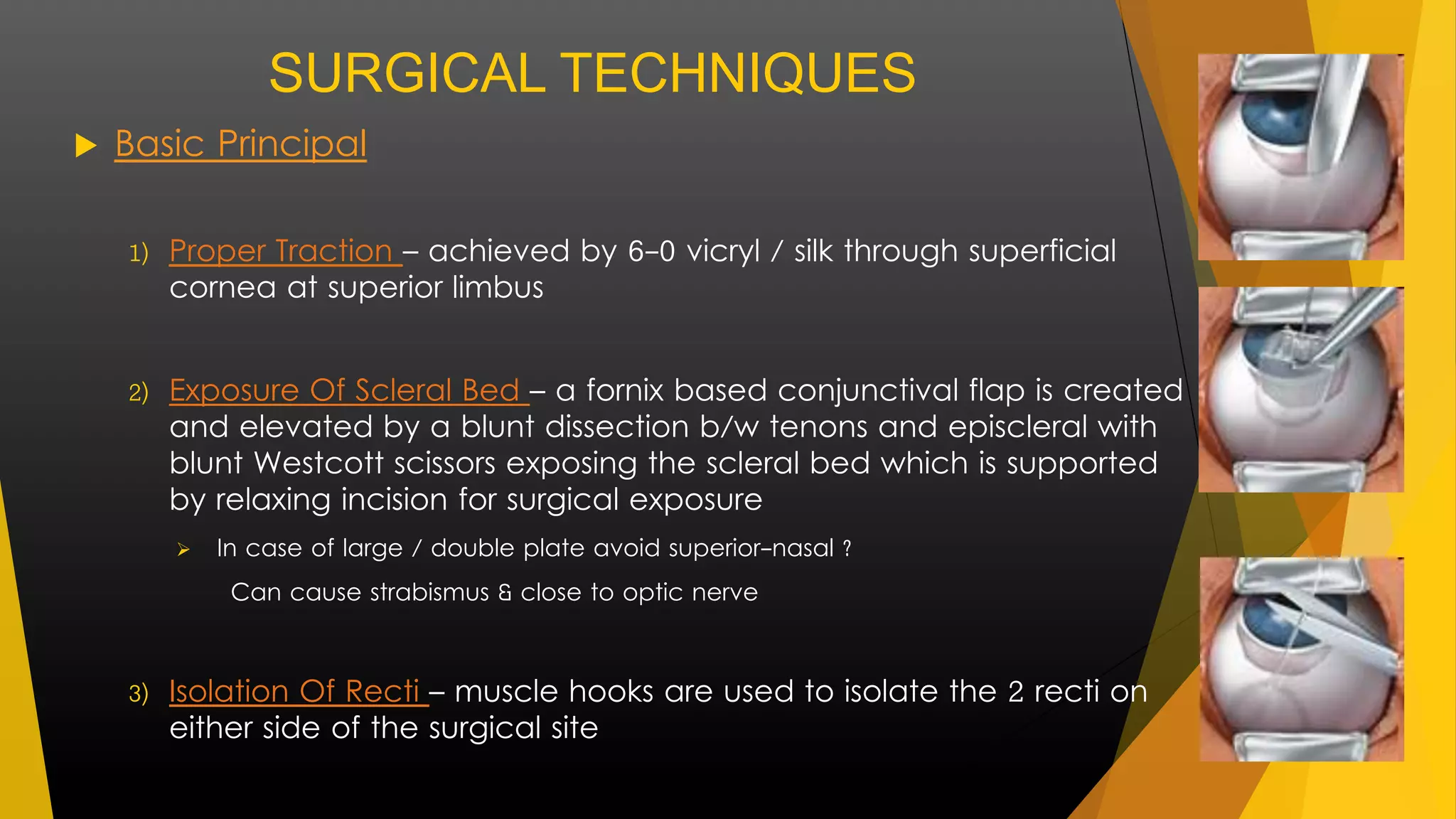 SURGICAL TECHNIQUES 
 Basic Principal 
1) Proper Traction – achieved by 6-0 vicryl / silk through superficial 
cornea at superior limbus 
2) Exposure Of Scleral Bed – a fornix based conjunctival flap is created 
and elevated by a blunt dissection b/w tenons and episcleral with 
blunt Westcott scissors exposing the scleral bed which is supported 
by relaxing incision for surgical exposure 
 In case of large / double plate avoid superior-nasal ? 
Can cause strabismus & close to optic nerve 
3) Isolation Of Recti – muscle hooks are used to isolate the 2 recti on 
either side of the surgical site 
 