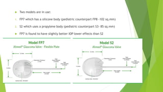  Two models are in use:
1. FP7 which has a silicone body (pediatric counterpart FP8 -102 sq.mm)
2. S2 which uses a propylene body (pediatric counterpart S3- 85 sq.mm)
 FP7 is found to have slightly better IOP lower effects than S2
 