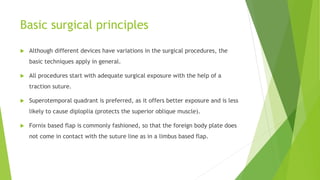 Basic surgical principles
 Although different devices have variations in the surgical procedures, the
basic techniques apply in general.
 All procedures start with adequate surgical exposure with the help of a
traction suture.
 Superotemporal quadrant is preferred, as it offers better exposure and is less
likely to cause diploplia (protects the superior oblique muscle).
 Fornix based flap is commonly fashioned, so that the foreign body plate does
not come in contact with the suture line as in a limbus based flap.
 