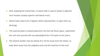  After exposing the scleral bed, a muscle hook is used to isolate 2 adjacent
recti muscles (usually superior and lateral recti).
 Valved tubes need to be irrigated, before placing them, to open them up
(Priming).
 The external plate is tucked posteriorly into the sub-Tenon space, underneath
the recti and sutured with non-absorbable 8-0 or 9-0 nylon to the sclera.
 The anterior border must be atleast 8 to 10 mm away from the limbus, to
keep them away from the palpebral area and the insertion of the recti.
 
