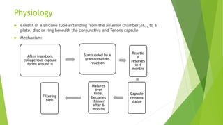 Physiology
 Consist of a silicone tube extending from the anterior chamber(AC), to a
plate, disc or ring beneath the conjunctiva and Tenons capsule
 Mechanism:
After insertion,
collagenous capsule
forms around it
Surrounded by a
granulomatous
reaction
Reactio
n
resolves
in 4
months
Capsule
remains
stable
Matures
over
time,
becomes
thinner
after 6
months
Filtering
bleb
 