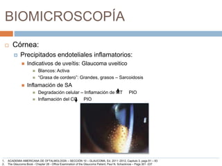 BIOMICROSCOPÍA
 Córnea:
 Precipitados endoteliales inflamatorios:
 Indicativos de uveítis: Glaucoma uveitico
 Blancos: Activa
 “Grasa de cordero”: Grandes, grasos – Sarcoidosis
 Inflamación de SA
 Degradación celular – Inflamación de MT PIO
 Inflamación del CC PIO
1. ACADEMIA AMERICANA DE OFTALMOLOGÍA – SECCIÓN 10 – GLAUCOMA, Ed. 2011 -2012, Capitulo 3, pags 81 – 83
2. The Glaucoma Book - Chapter 28 - Office Examination of the Glaucoma Patient, Paul N. Schacknow – Pags 301 -337
 