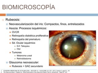 BIOMICROSCOPÍA
 Rubeosis:
 Neovascularización del iris: Compactos, finos, entrelazados
 Asocia: Procesos isquémicos:
 OVCR
 Retinopatía diabética proliferativa
 Retinopatía del prematuro
 Sd. Ocular isquémico
 Enf. Takayasu
 FAV
 Tumores
 Melanoma uveal
 Retinoblastoma
 Glaucoma neovascular:
 Rubeosis + GAC secundario
1. ACADEMIA AMERICANA DE OFTALMOLOGÍA – SECCIÓN 10 – GLAUCOMA, Ed. 2011 -2012, Capitulo 3, pags 81 – 83
2. The Glaucoma Book - Chapter 28 - Office Examination of the Glaucoma Patient, Paul N. Schacknow – Pags 301 -337
 