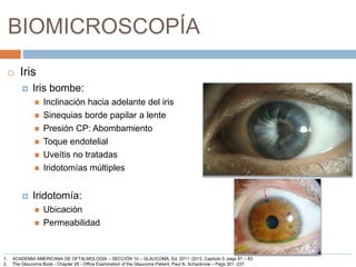 BIOMICROSCOPÍA
 Iris
 Iris bombe:
 Inclinación hacia adelante del iris
 Sinequias borde papilar a lente
 Presión CP: Abombamiento
 Toque endotelial
 Uveítis no tratadas
 Iridotomías múltiples
 Iridotomía:
 Ubicación
 Permeabilidad
1. ACADEMIA AMERICANA DE OFTALMOLOGÍA – SECCIÓN 10 – GLAUCOMA, Ed. 2011 -2012, Capitulo 3, pags 81 – 83
2. The Glaucoma Book - Chapter 28 - Office Examination of the Glaucoma Patient, Paul N. Schacknow – Pags 301 -337
 