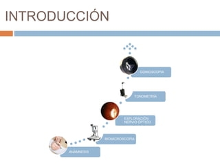 INTRODUCCIÓN
ANAMNESIS
BIOMICROSCOPÍA
EXPLORACIÓN
NERVIO ÓPTICO
TONOMETRÍA
GONIOSCOPIA
 