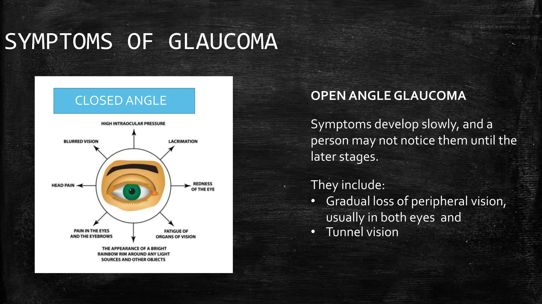 SYMPTOMS OF GLAUCOMA
CLOSED ANGLE OPEN ANGLE GLAUCOMA
Symptoms develop slowly, and a
person may not notice them until the
later stages.
They include:
• Gradual loss of peripheral vision,
usually in both eyes and
• Tunnel vision
 
