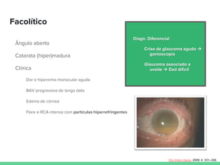 Facolítico
Ângulo aberto
Catarata (hiper)madura
Clínica
Dor e hiperemia monocular aguda
BAV progressiva de longa data
Edema de córnea
Flare e RCA intensa com partículas hiperrefringentes
Diagn. Diferencial
Crise de glaucoma agudo 
gonioscopia
Glaucoma associado a
uveíte  Dxd difícil
Clin Interv Aging. 2009; 4: 331–336.
 